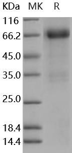 Mouse Follistatin/FST (FS288) Recombinant Protein (Fc Tag) (Active) (RPES5160)