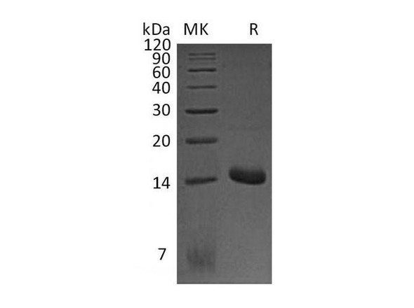 Mouse CCL3 Recombinant Protein (His Tag) (RPES5168)