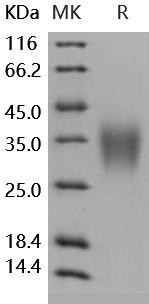 Human ACVR2B/ActivinR-IIB Recombinant Protein (RPES5177)