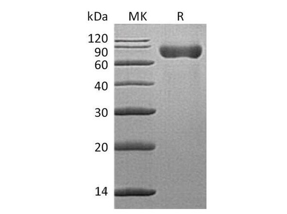 Mouse SLAMF3/CD229 Recombinant Protein (RPES5190)