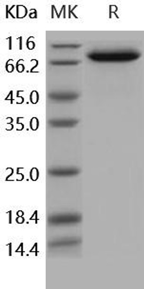 Human IL18RAP/IL1R7 Recombinant Protein (RPES5244)