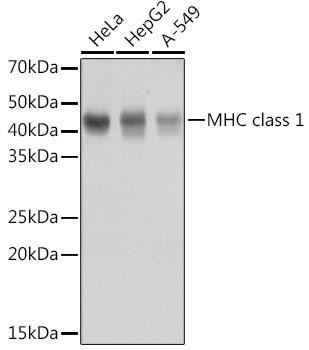 HLA-A Rabbit Monoclonal Antibody (CAB11406)