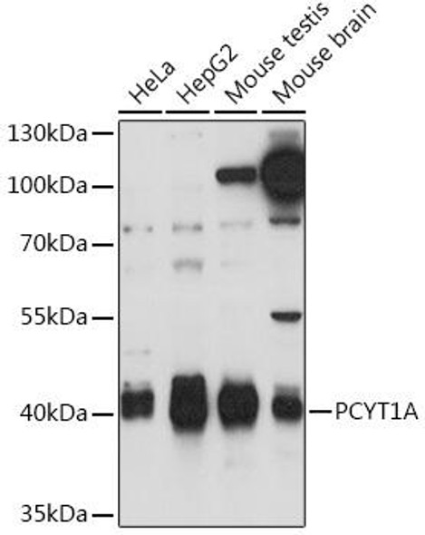 PCYT1A Rabbit Polyclonal Antibody (CAB16943)