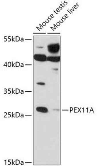 Anti-PEX11A Antibody (CAB17576)