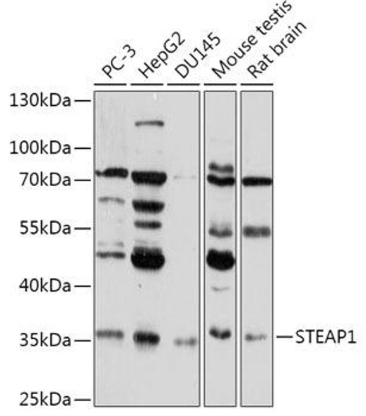STEAP1 Rabbit Polyclonal Antibody (CAB17684)