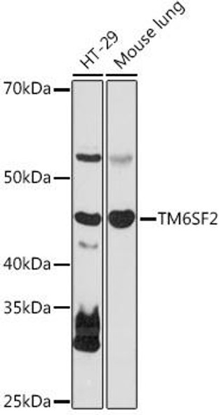 Anti-TM6SF2 Antibody (CAB18649)