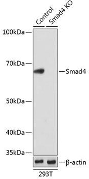 Anti-Smad4 Antibody [KO Validated] (CAB19116)