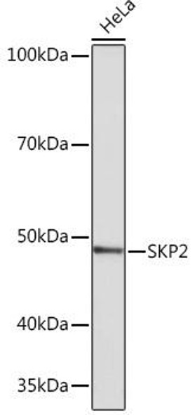 Anti-SKP2 Antibody (CAB4046)