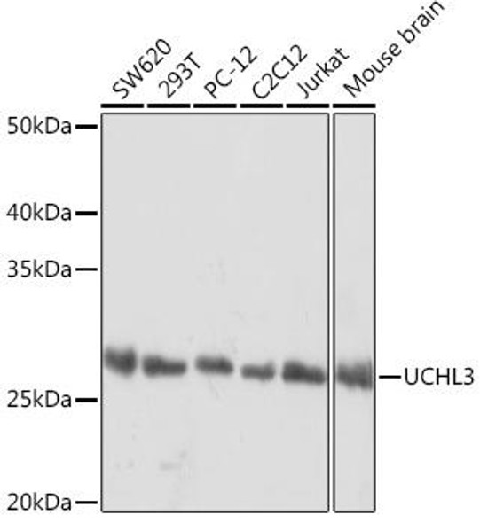 Anti-UCHL3 Antibody (CAB1372)