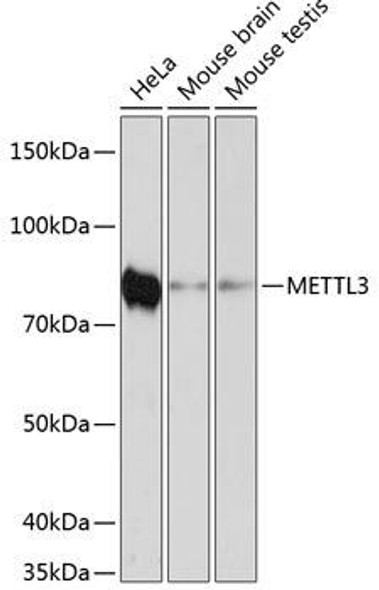 [KO Validated] METTL3 Rabbit Monoclonal Antibody (CAB19079)
