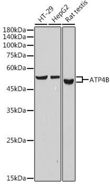 Anti-ATP4B Antibody (CAB19280)