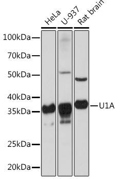 U1A/SNRPA Rabbit Monoclonal Antibody (CAB3686)