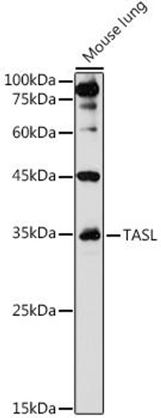 Anti-TASL Antibody (CAB20486)