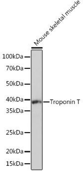 Cardiac troponin T (TNNT2) Rabbit Monoclonal Antibody (CAB4914)