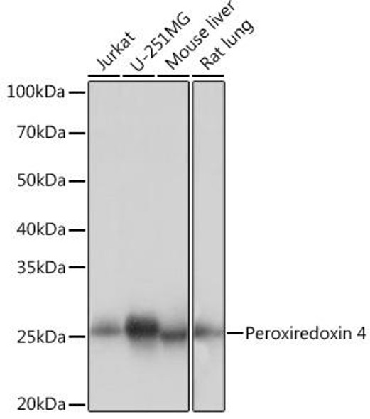 Peroxiredoxin 4 (PRDX4) Rabbit Monoclonal Antibody (CAB9131)