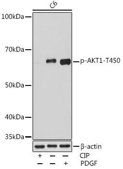 Phospho-AKT1-T450 Rabbit Monoclonal Antibody (CABP0980)