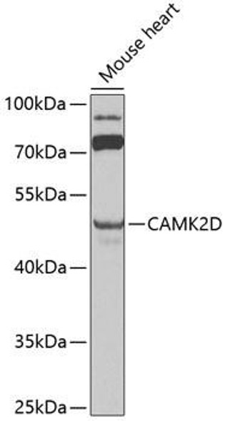Anti-CAMK2D Antibody (CAB0656)