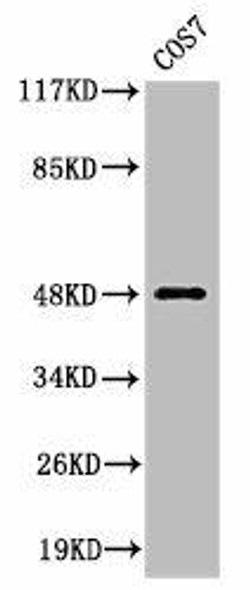 Cleaved-MMP27 (Y99) Antibody (PACO00037)