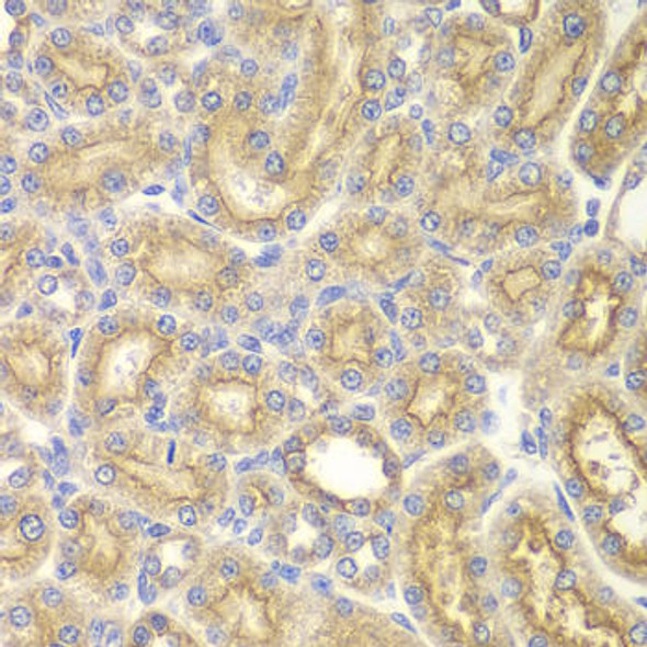 Anti-PAK1 Antibody (CAB0809)