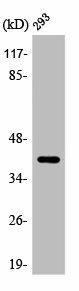 ARRDC2 Antibody (PACO00428)