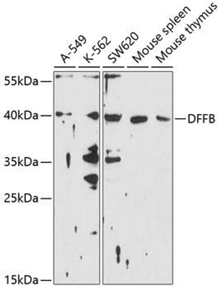 Anti-DFFB Antibody (CAB10110)