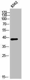 CHST13 Antibody (PACO02575)