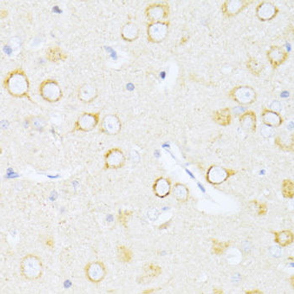 Anti-Caspase-8 Antibody (CAB11324)