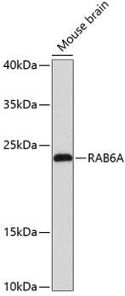 Anti-RAB6A Antibody (CAB12089)