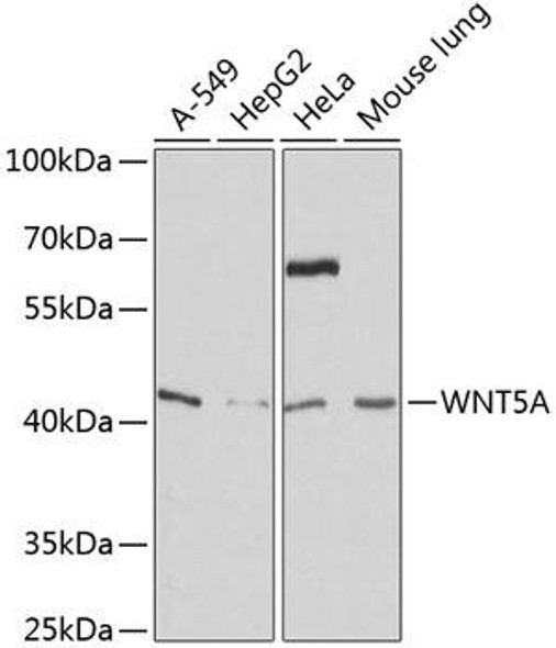 Anti-WNT5A Antibody (CAB12744)