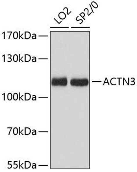 Anti-ACTN3 Antibody (CAB12797)