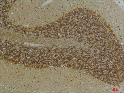 KCNN2 Antibody (PACO07185)