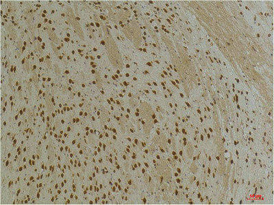 KCNG3 Antibody (PACO07192)