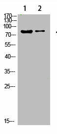 COL8A2 Antibody (PACO07443)