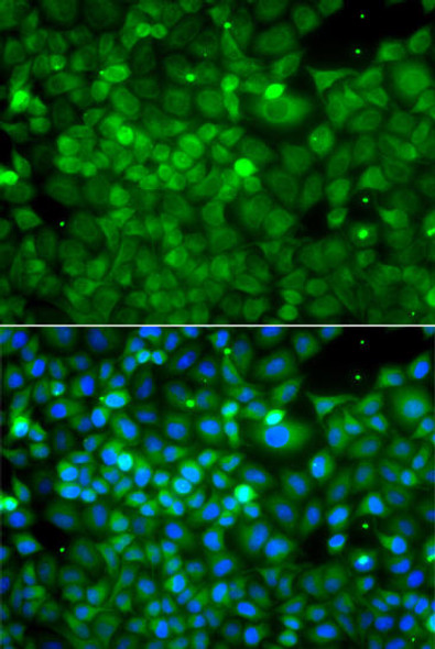 Anti-POC1A Antibody (CAB13409)