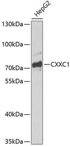 Anti-CXXC1 Antibody (CAB13424)