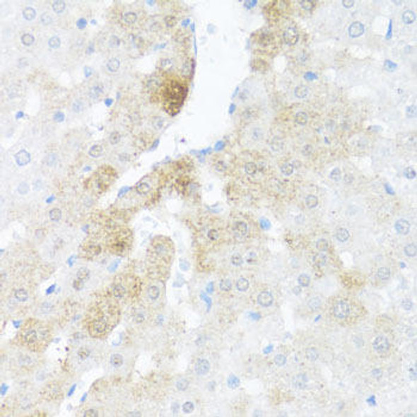 Anti-Bcl-W Antibody (CAB13471)