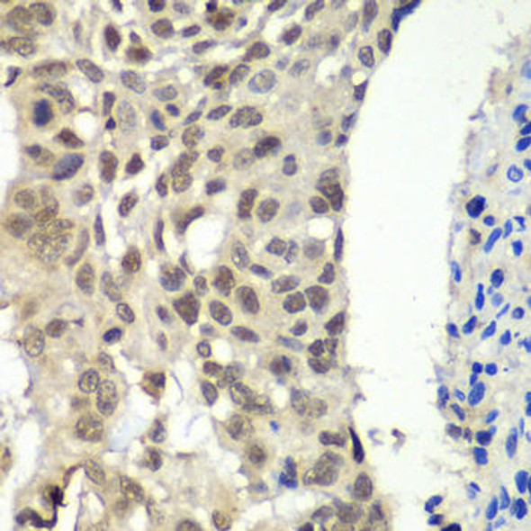 Anti-SSRP1 Antibody (CAB13636)