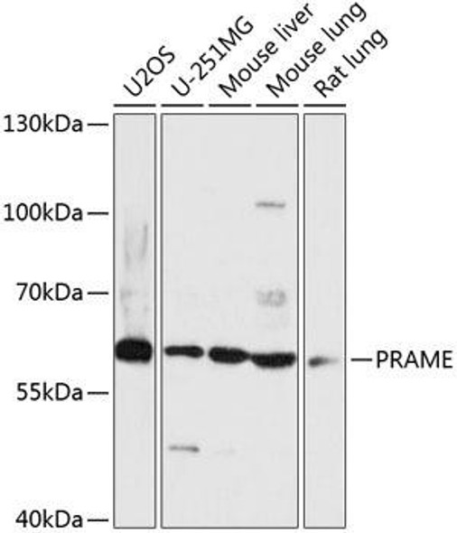 Anti-PRAME Antibody (CAB14507)