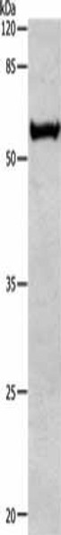 ALDH1A1/ALDH1A2/ALDH1A3 Antibody (PACO13833)