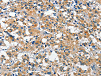 CUL7 Antibody (PACO14301)