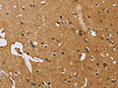 NRN1 Antibody (PACO14756)