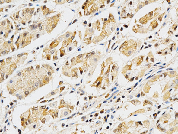 Anti-LGALS3 Antibody (CAB1464)