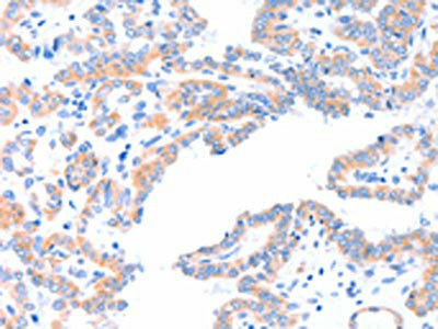 AADACL2 Antibody (PACO15217)