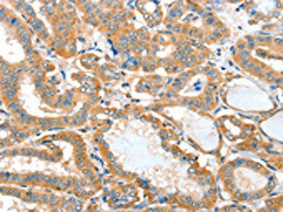 ACOT11 Antibody (PACO15261)