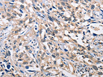ALG8 Antibody (PACO15386)