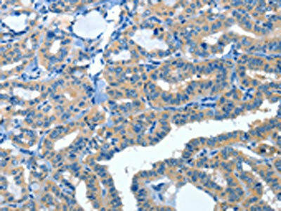 AMDHD2 Antibody (PACO15418)