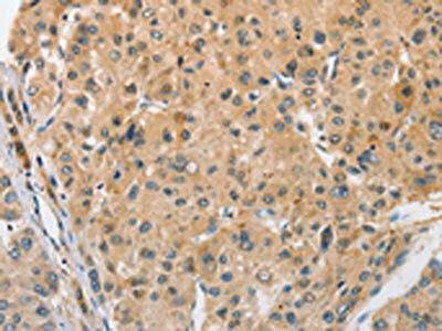 ARL8A Antibody (PACO15527)