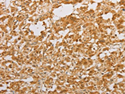 STK40 Antibody (PACO15679)