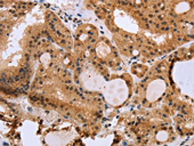 EPDR1 Antibody (PACO16259)