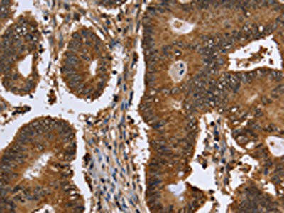 FANCF Antibody (PACO16308)